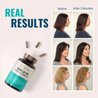 Hair La Vie Clinical Formula Hair Growth Supplement for Women & Men – 2 Pack